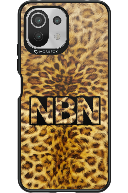 Cheetahh - Xiaomi Mi 11 Lite (2021)