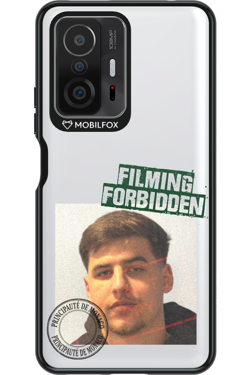 Sorin Mugshot - Xiaomi Mi 11T