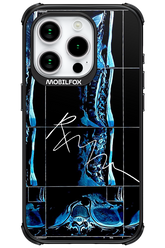 RMN Scolioza - Apple iPhone 15 Pro