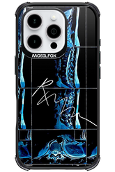 RMN Scolioza - Apple iPhone 16 Pro