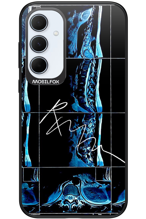 RMN Scolioza 2.0 - Samsung Galaxy A35