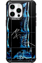 RMN Scolioza - Apple iPhone 15 Pro Max