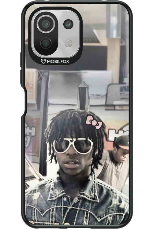 Drip ‘n’ Bow 2.0 - Xiaomi Mi 11 Lite (2021)