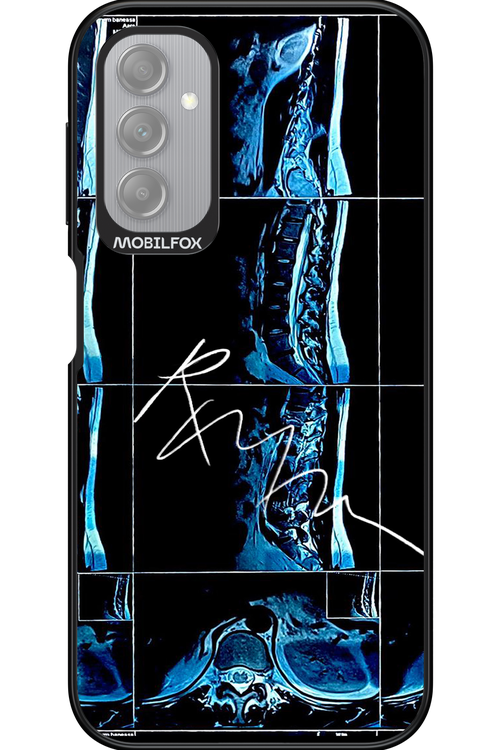 RMN Scolioza 2.0 - Samsung Galaxy A14