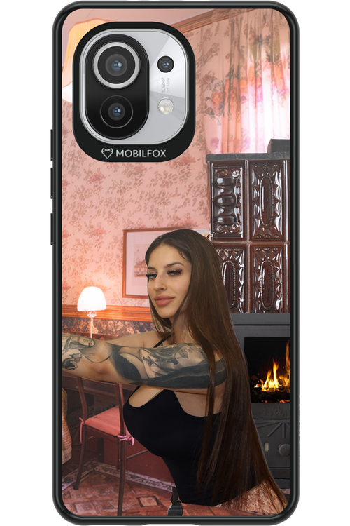 Tattooed Flame - Xiaomi Mi 11 5G