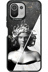 Medusa - Xiaomi Mi 11 Lite (2021)