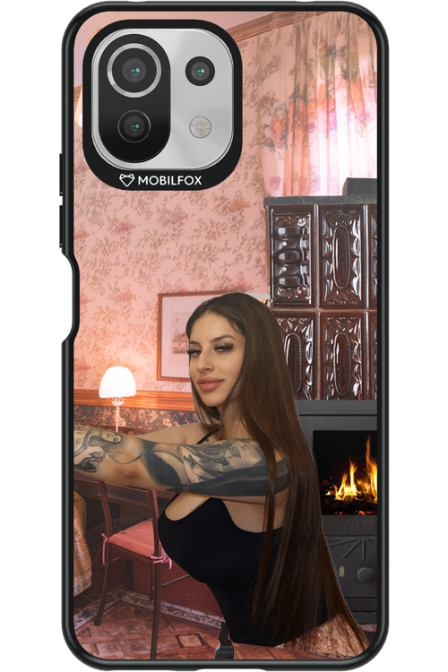 Tattooed Flame - Xiaomi Mi 11 Lite (2021)