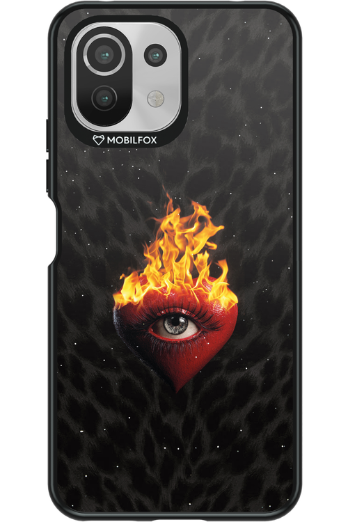 Shit happens - Xiaomi Mi 11 Lite (2021)