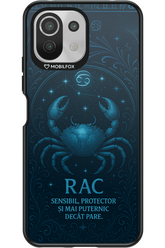 Rac - Xiaomi Mi 11 Lite (2021)