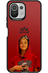 Small King - Xiaomi Mi 11 Lite (2021)