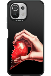 Broken Heart Right - Xiaomi Mi 11 Lite (2021)