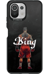 King - Xiaomi Mi 11 Lite (2021)