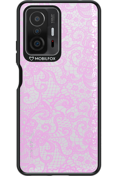 Dantela 2.0 - Xiaomi Mi 11T