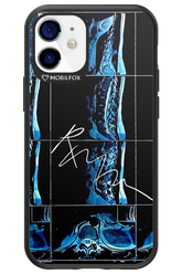 RMN Scolioza 2.0 - Apple iPhone 12 Mini