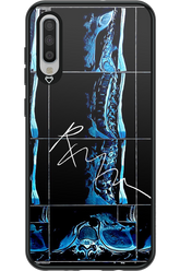 RMN Scolioza 2.0 - Samsung Galaxy A70