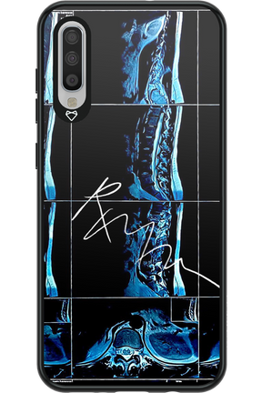 RMN Scolioza 2.0 - Samsung Galaxy A70