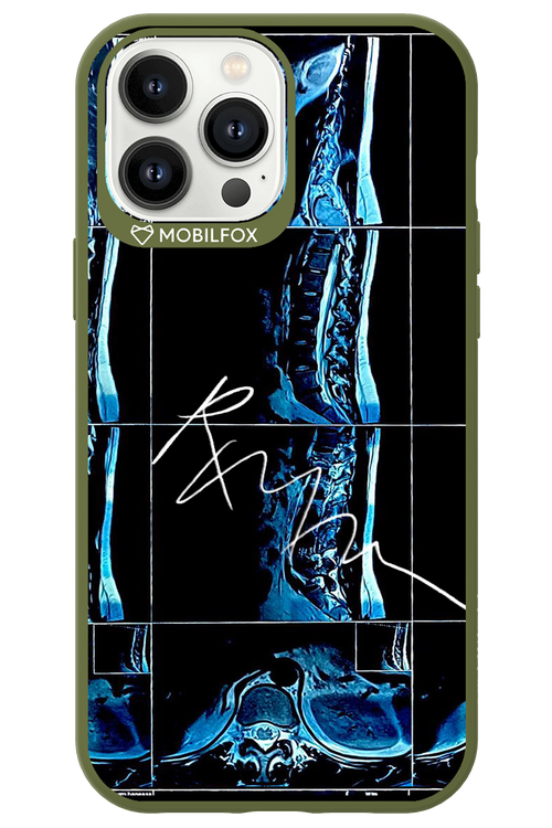 RMN Scolioza 2.0 - Apple iPhone 13 Pro Max