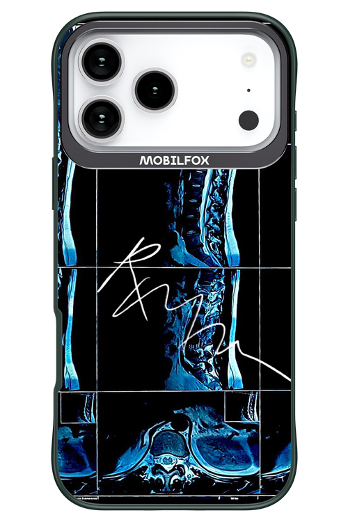 RMN Scolioza 2.0 - Apple iPhone 17 Pro Max
