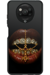 Greedy - Xiaomi Poco X3 NFC