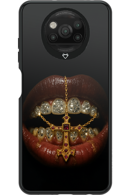 Greedy - Xiaomi Poco X3 NFC