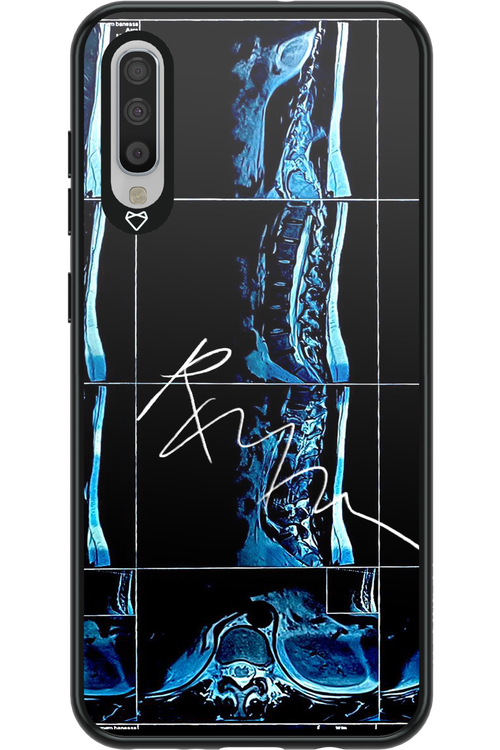 RMN Scolioza 2.0 - Samsung Galaxy A70