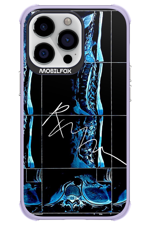 RMN Scolioza 2.0 - Apple iPhone 13 Pro