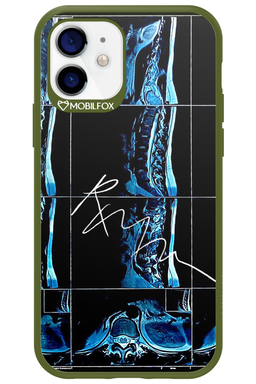 RMN Scolioza 2.0 - Apple iPhone 12