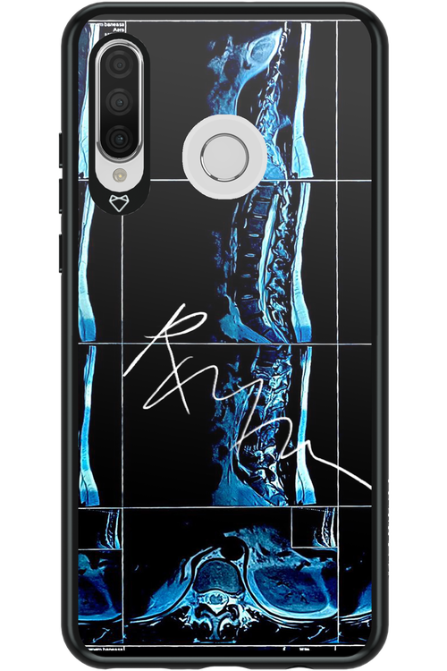 RMN Scolioza 2.0 - Huawei P30 Lite