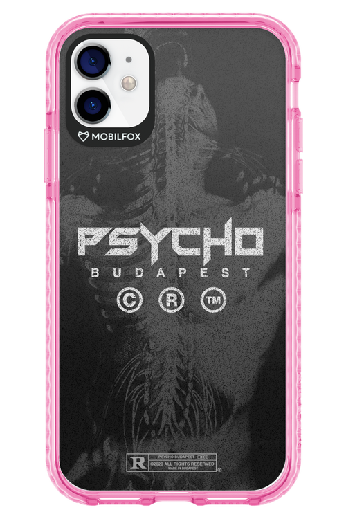 X-Ray - Apple iPhone 11
