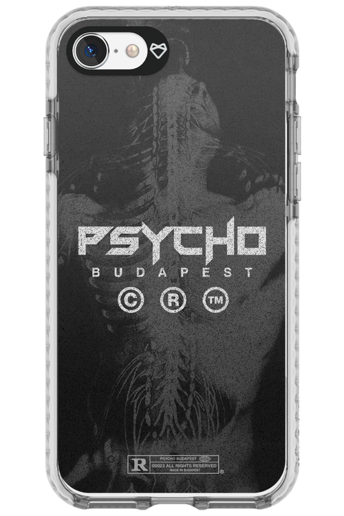 X-Ray - Apple iPhone 8