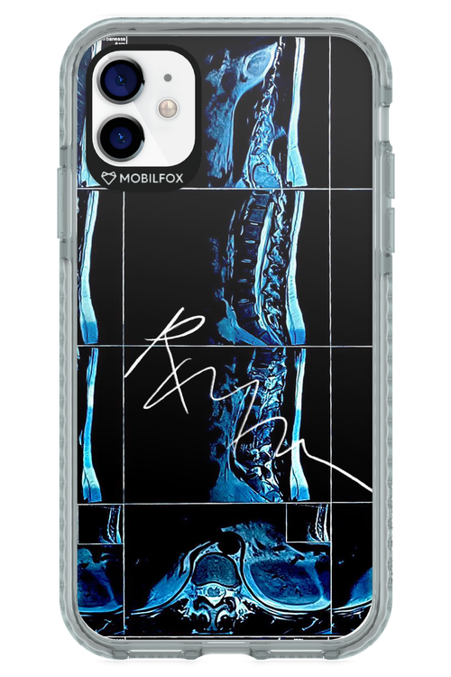 RMN Scolioza 2.0 - Apple iPhone 11