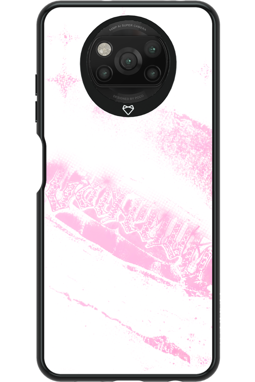 Grillz Pink White Centaur 2.0 - Xiaomi Poco X3 Pro