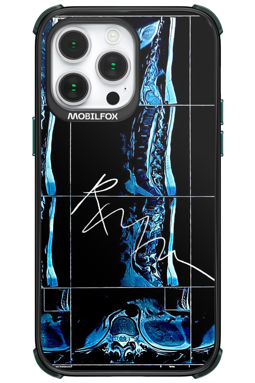 RMN Scolioza 2.0 - Apple iPhone 14 Pro Max