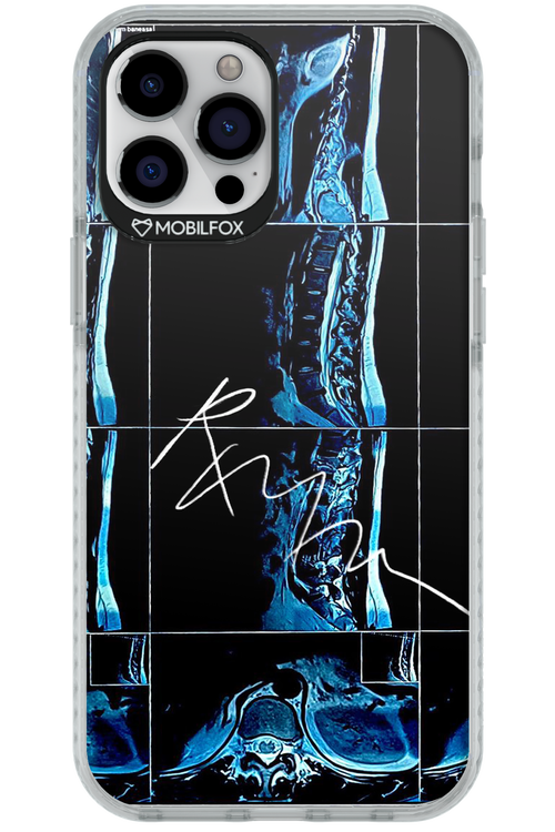 RMN Scolioza 2.0 - Apple iPhone 12 Pro Max
