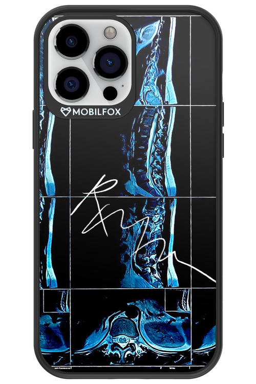 RMN Scolioza 2.0 - Apple iPhone 13 Pro Max