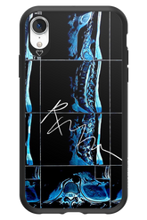 RMN Scolioza 2.0 - Apple iPhone XR