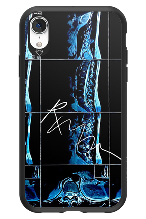 RMN Scolioza 2.0 - Apple iPhone XR