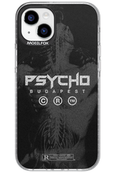 X-Ray - Apple iPhone 15 Plus