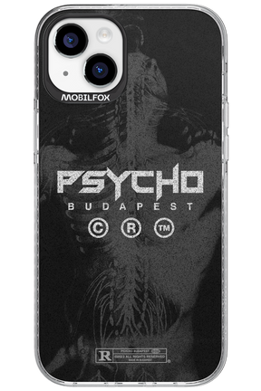 X-Ray - Apple iPhone 15 Plus