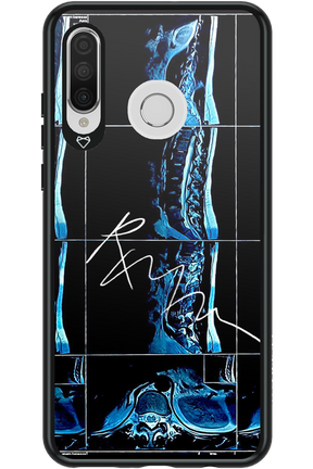 RMN Scolioza 2.0 - Huawei P30 Lite