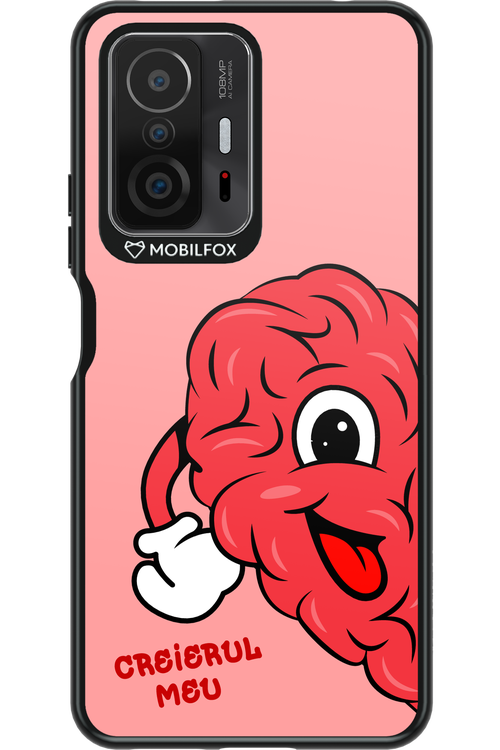 One Mind - Xiaomi Mi 11T