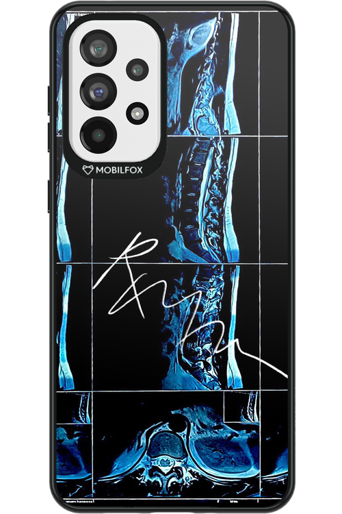 RMN Scolioza 2.0 - Samsung Galaxy A73
