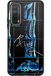 RMN Scolioza 2.0 - Huawei P Smart 2021