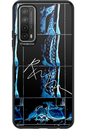 RMN Scolioza 2.0 - Huawei P Smart 2021
