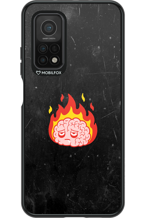 My brain - Xiaomi Mi 10T 5G