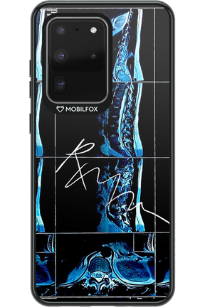 RMN Scolioza 2.0 - Samsung Galaxy S20 Ultra 5G
