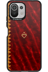 Spania x Mobilfox 2.0 - Xiaomi Mi 11 Lite (2021)