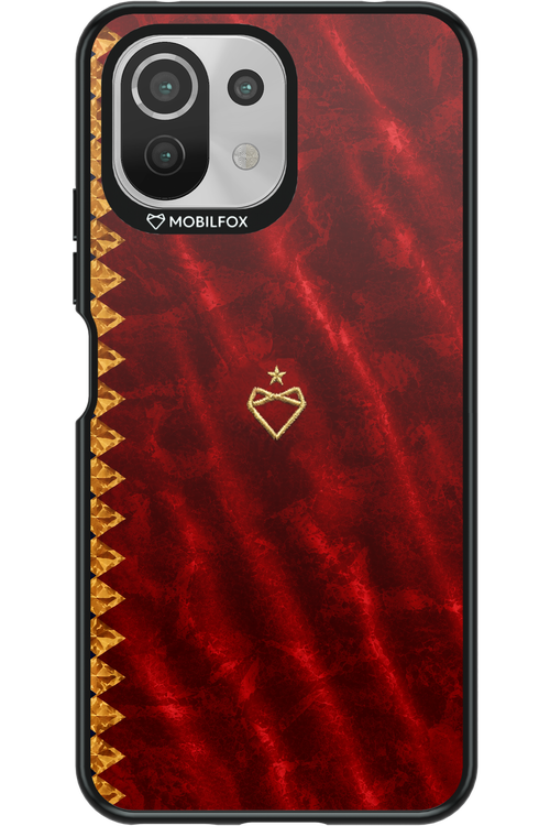 Spania x Mobilfox 2.0 - Xiaomi Mi 11 Lite (2021)