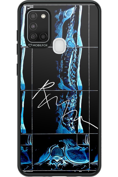 RMN Scolioza 2.0 - Samsung Galaxy A21 S