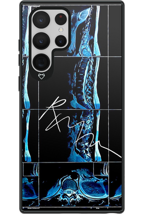 RMN Scolioza 2.0 - Samsung Galaxy S22 Ultra